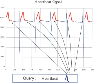 Figure 1.3: Subsequence Matching in a Single Channel