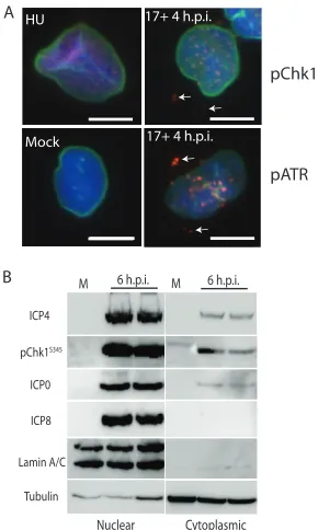 FIG 7 Activated Chk1 and ATR are found in the nucleus and also in the cytoplasm where they sometimescolocalize with ICP4