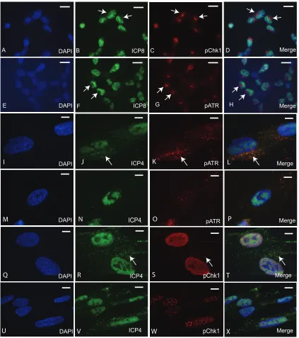 FIG 2 Localization of pATR and pChk1 following HSV-1 17pATR in cytoplasm. (M to P) Localization of DAPI, ICP4, and pATRof rabbit pChk1 antibody to a juxtanuclear position