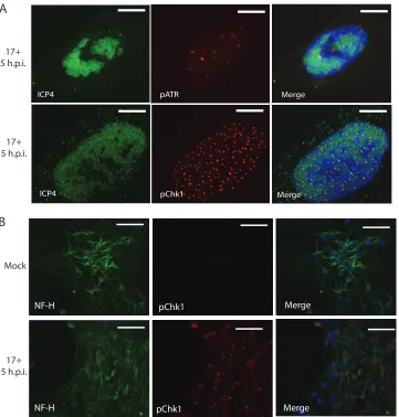 FIG 3 Additional micrographs of pATR and pChk1 distribution in HFL and LUHMES cells. (A) High-magniﬁcationmicrographs of extracted, Fc receptor-blocked HFL cells show association of both pATR and pChk1 in punctaclosely associated with HSV-1 replication cen