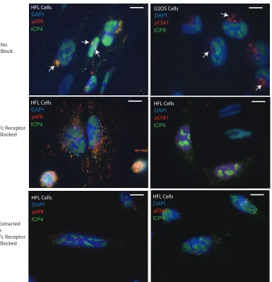 FIG 4 Comparison of the 3 different immunoﬂuorescence protocols used in this study. The top micrographs were capturedof cells prepared with no block of the Fc receptor
