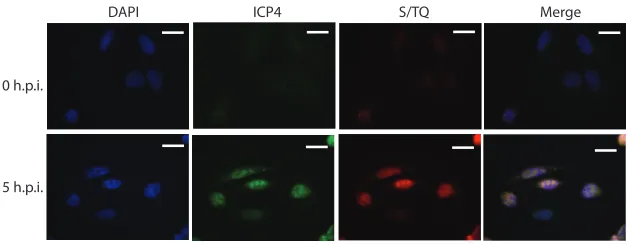 FIG 5 ATR/ATM substrate antibody (S/TQ) shows little nuclear reactivity at 0 h.p.i. by 17unextracted U2OS cells but is highly reactive with HSV-1 replication centers where it colocalizes with ICP4at 5 h.p.i