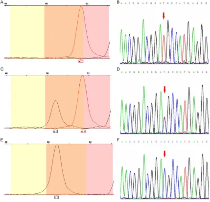 Figure 1. Genotyping pictures and forward sequencing graphs of F12 C46T polymorphism. Note: A and B are for TT genotype; C and D are for TC genotype; E and F are for CC genotype of F12 C46T polymorphism.