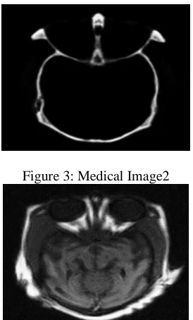 Figure 3: Medical Image2 