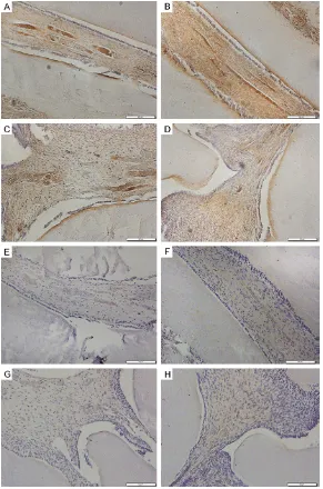 Figure 9. Expression of NFH (A-D) in nerve fibers, and MBP (E-H) in myelin-ated fibers in rat pulp as shown by IHC
