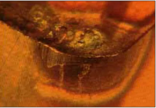 Figure 2.8 : Crater wear (source : SANDVIK Coromant) 