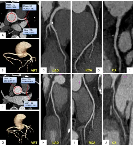 Figure 2. Comparison of case 1 from Protocol A with the SAFIRE algorithm and case 2 from Protocol D (Group D1) with the FBP algorithm.