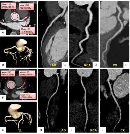 Figure 5. Comparison of case 3 from Protocol B (Group B2) with the SAFIRE algorithm and case 4 from Protocol D (Group D2) with the SAFIRE algorithm.
