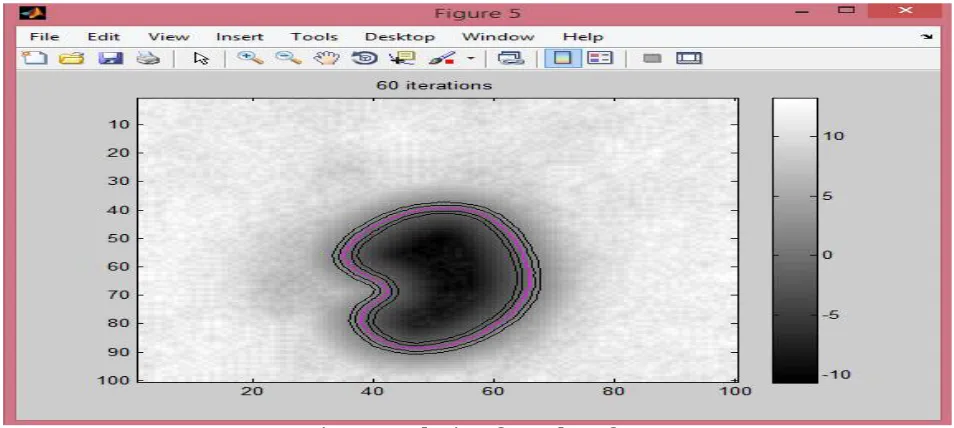 Fig 7 : Smoothening of Boundary of OC.  