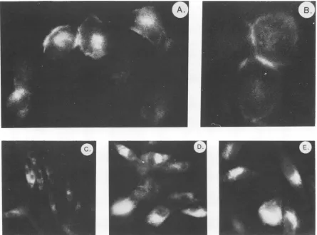 FIG. 4.(D),permeabilized, Immunofluorescent staining of cells infected with PrA RSV or mutant viruses