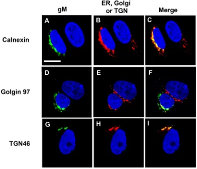 FIG 7 HSV-1 gM inhibits the processing of HIV-1 gp160 and release of gp120 in the absence of otherHIV-1 proteins