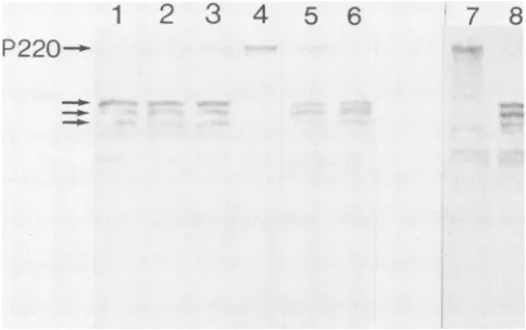 FIG.1.CBPmixtureI-S10(U-S10)(I-S10);U-Sl01 In vitro assay for the protease which cleaves P220 of the complex