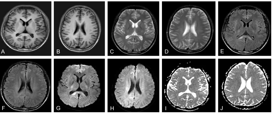 Figure 3. MRI lesions of the brain involved only the corpus callosum 25 days after diagnosis
