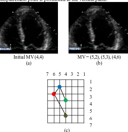 Fig. 7.  (a) Original cardiovascular ultrasound image (b) Predicted       (c) cardiovascular ultrasound image with Gaussian Filter (c) Motion Velocity 
