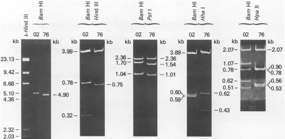 FIG.1.gels,the Comparison of LPV-02 and LPV-76 DNA. Purified form I DNA from LPV-02- or LPV-76-infected BJA-B cells was digested with restriction endonucleases indicated and electrophoresed