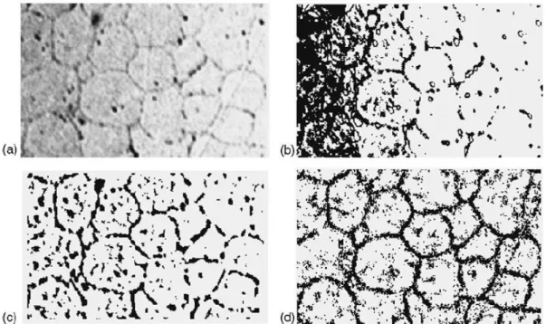 Figure 4- 2 An example taken from (Dengiz et al., 2005) showing the segmentation results using  the  proposed  algorithm:  (a)  a  smoothed  and  contrast  enhanced  source  image;  (b)  output  of  simple  thresholding  by  hand;  (c)  output  of  the  fu