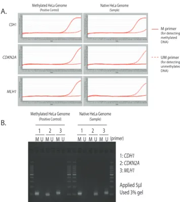 Figure 7. Bisulfite-treated genomic DNA was used in qMSP reactions (A) or in  MSP using end-point detection (B)