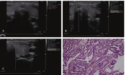 Table 1. The conventional ultrasound features of the thyroid nodules