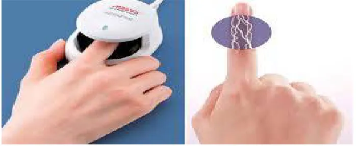 Figure 1: Finger Vein Recognition 