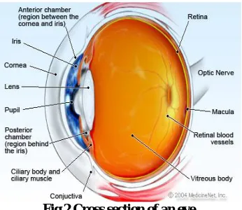 Fig .1 Optic Disc 