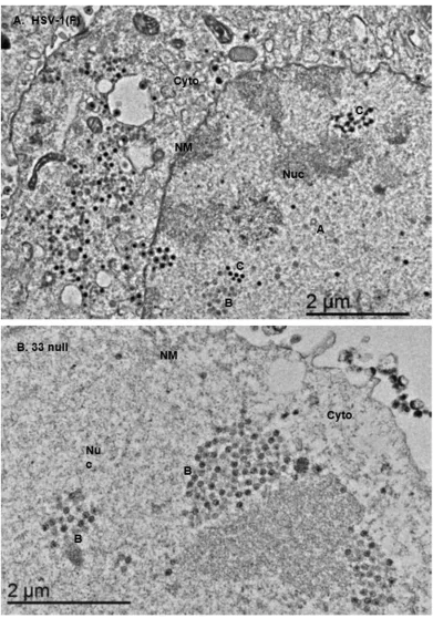 FIG 6 Transmission electron microscopic examination of CV1 cells infected with HSV-1 or Uwith uranyl acetate, and examined with a transmission electronic microscope