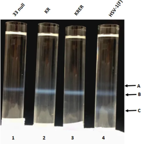 FIG 7 Image of light-refracting capsid-speciﬁc bands in continuous 20 to 50% sucrose gradients
