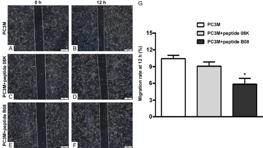Figure 4. Effect of peptide B08 on the migration of PC-3M cells. Migrated cells were photographed at 0 h and 12 h