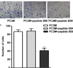 Figure 6. Effect of peptide B08 on the level of VEGFA protein. A: VEGFA and GAPDH mRNA were determined by PCR in PC-3M, PC-3M with peptide 08K and PC-3M with peptide B08