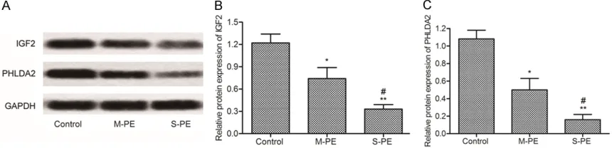 Figure 1. mRNA levels of IGF2 and PHLDA2 in placenta. RT-PCR analysis was used to determine the relative mRNA expression levels of IGF2 and PHLDA2 in placenta