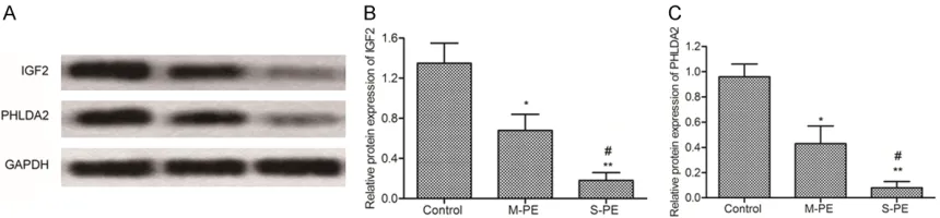 Figure 5. mRNA levels of IGF2 and PHLDA2 in serum. A: mRNA Expression of IGF2 and PHLDA2 was analyzed by RT-PCR
