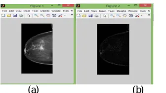 Fig :2 (a)                            (b) (a) ORIGINAL IMAGE (b) OUTPUT OF MEDIAN FILTER  