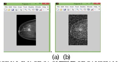 TABLE 3: PSNR AND MSE VALUES FOR GAUSSIAN FILTER Image MSE PSNR 