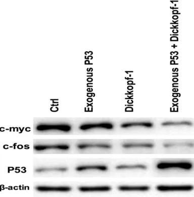 Figure 4. Effects of exogenous P53 and Dickkopf-1 on the gene expression of c-myc, c-fos, P53 in MG-63 cells.