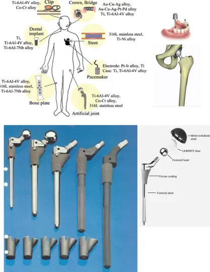 Figure 1- 1 Metallic devices and metallic biomaterials’ applications [11]. 