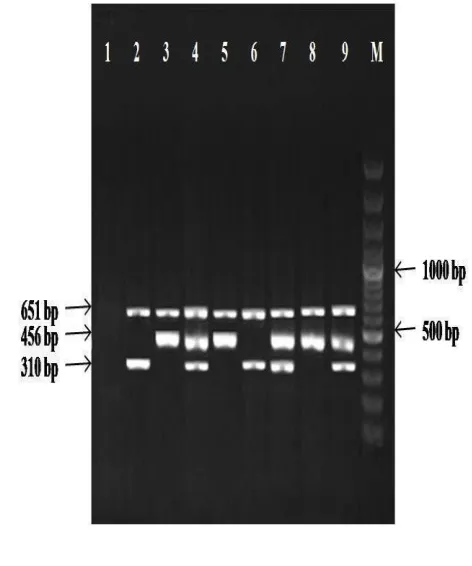 Figure 1. Gel electrophoresis profiles showing multiplex-PCR products of some Staphylococcus strains