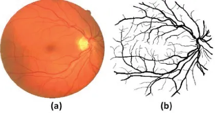 Figure 1 a. Digital Image of Human Retina   b. Vascular Pattern