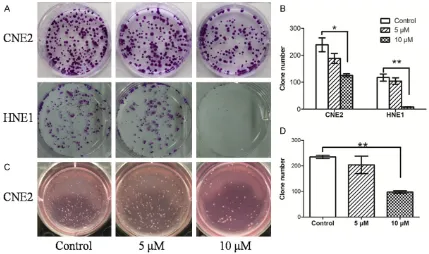 Figure 2. Effects of SAA on colony-forming ability of CNE2 and HNE1 cells. A. Cell colony formation was examined 0.05; **colony-forming ability of CNE2 cells in soft agar experiments, **using the colony formation assay