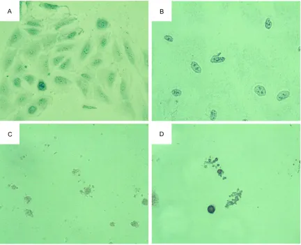 Figure 3. Apoptosis of A549 cells after different treatments (Giemsa staining). A: Control; B: DDP (1 µg/ml); C: OA (20 ng/ml); D: DDP (1 µg/ml) + OA (20 ng/ml).