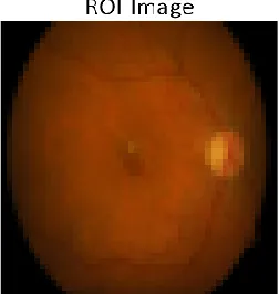 Figure 4.4:  (a) ROI  image, (b)Extracted feature 