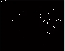 Figure 4: Optic Disc Elimination 