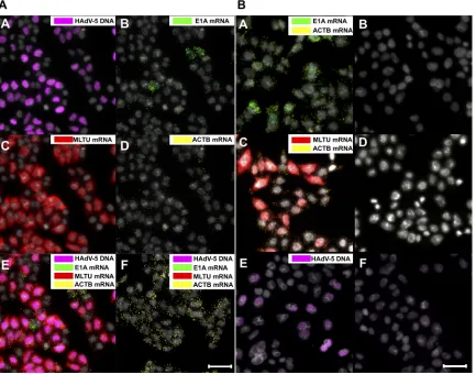 FIG 2 Concurrent25 hpi according to the standard protocol (images A and C). Reverse transcriptase was omitted from the cDNA synthesis reaction (imagesB and D)