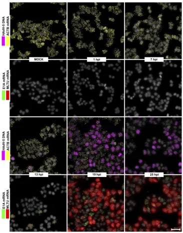 FIG 3 Temporal expression pattern of HAdV-5 mRNAs in infected HeLa cells. HeLa cells infected with HAdV-5 (10(exon I_II and exon II_III, red)