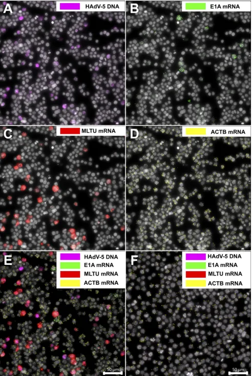 FIG 6 Concurrent detection of HAdV-5 DNA and mRNAs in long-term infected BJAB cells. BJAB cells wereinfected with HAdV-5 (100 FFU/cell) and analyzed 6 days postinfection (dpi)