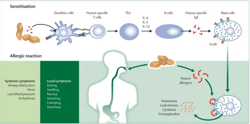 Figure 1. Sensitization and allergic reaction to peanut. Cited from [53]. 