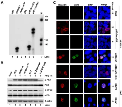 FIG 9 BocaSR-facilitated HBoV1 DNA replication in the nucleus does not involve the cytoplasmic PKR pathway