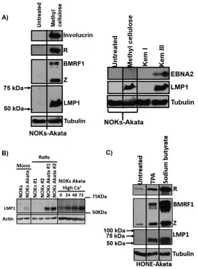 FIG 1 Cellular differentiation induces LMP1 expression in epithelial cells. (A) NOKs-Akata cells were eitherlevels of viral proteins (Z, R, BMRF1, and LMP1) and the cellular protein tubulin (as a loading control).grown in a monolayer or suspended in methyl