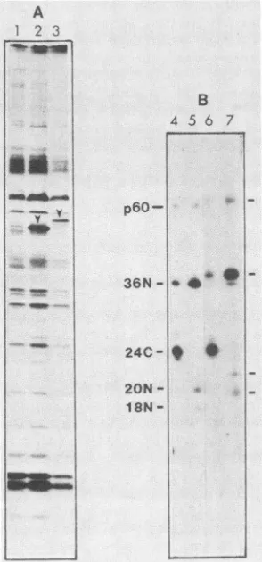 FIG. 2.Cellsarrows.60-kDaresistrophoresis.digestedwerenusExposurelabeledp6OSr(beledbeledspecificindicated.labeledPR-RSV-C-infectedlabeled[35S]methionine-labeled (A) [3H]myristic acid-labeled proteins in cell lysates