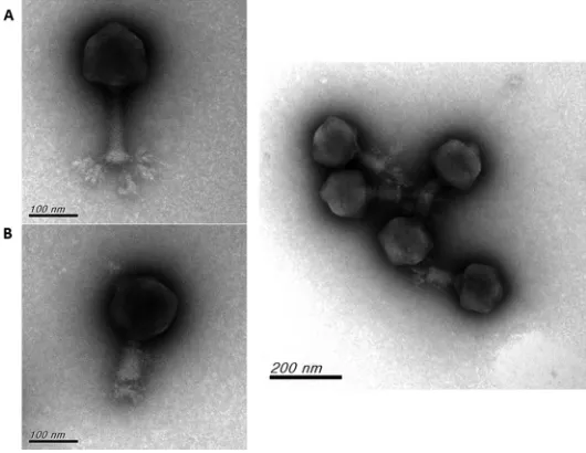 FIG 4 Comparison of the coding regions of putative capsule depolymerases ofand its homolog indegree of similarity (no signiﬁcant sequence similarity (and thus were unable to correlate to any genes in this region) areindicated by white arrows
