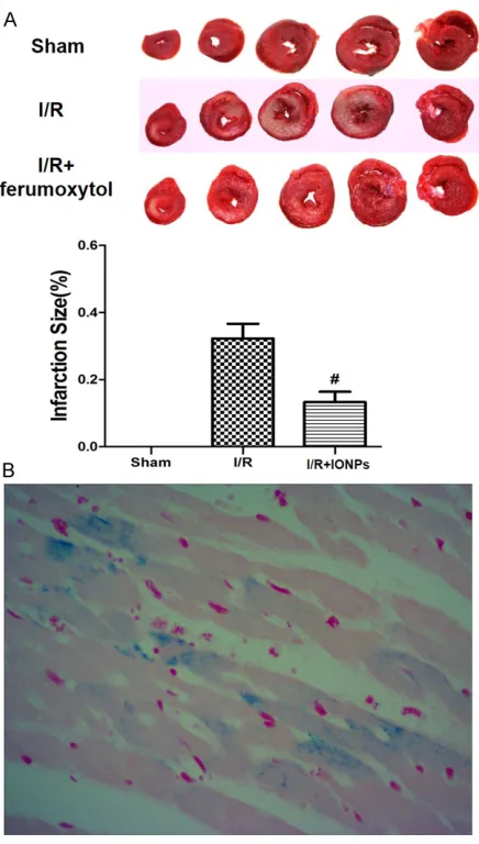 Figure 1. Effects of ferumoxytol on the area of sian blue staining was applied to visualize the iron deposition around ischemia myocardial tis-sue