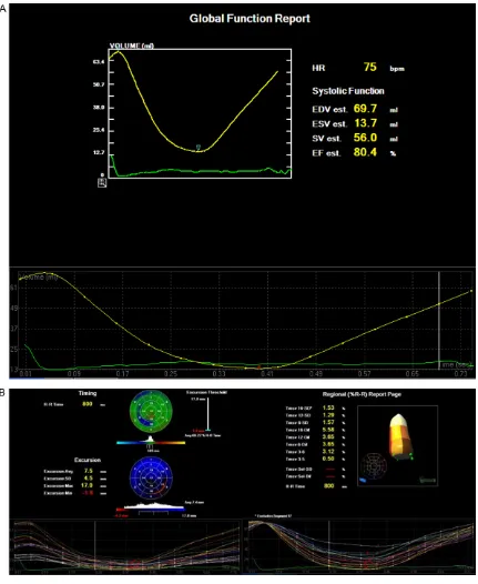 Figure 1. Qualitative research. A: Normal left ventricular volume-time curve; B: Normal regional left ventricular curve.